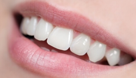 Gesunde Zähne ohne Zahnbelag 